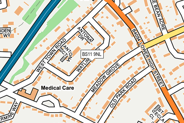 BS11 9NL map - OS OpenMap – Local (Ordnance Survey)