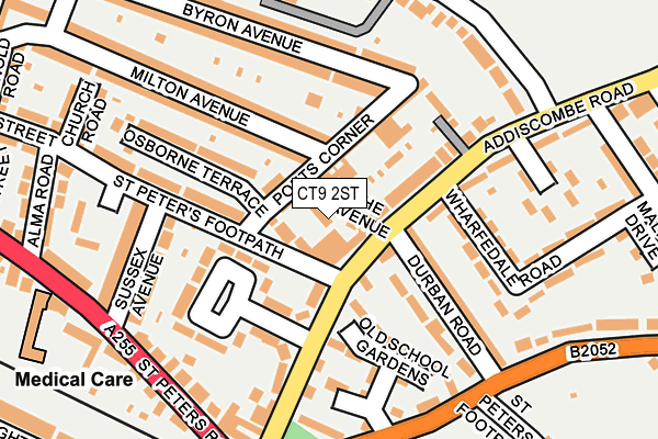 CT9 2ST map - OS OpenMap – Local (Ordnance Survey)